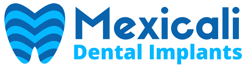 Mexicali Dental Implants Clinic